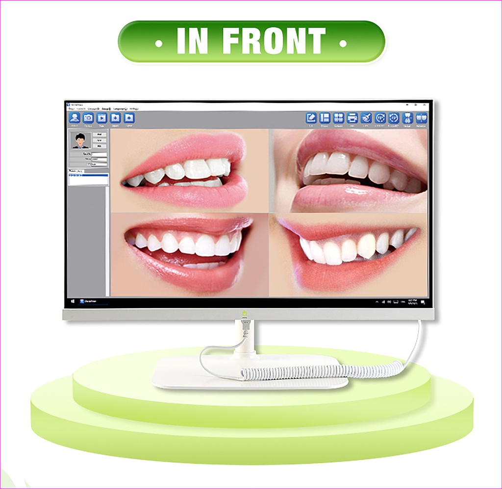 Set Monitor computador + Cámara intraoral de Sobremesa Eco-Camera 01 Appledental