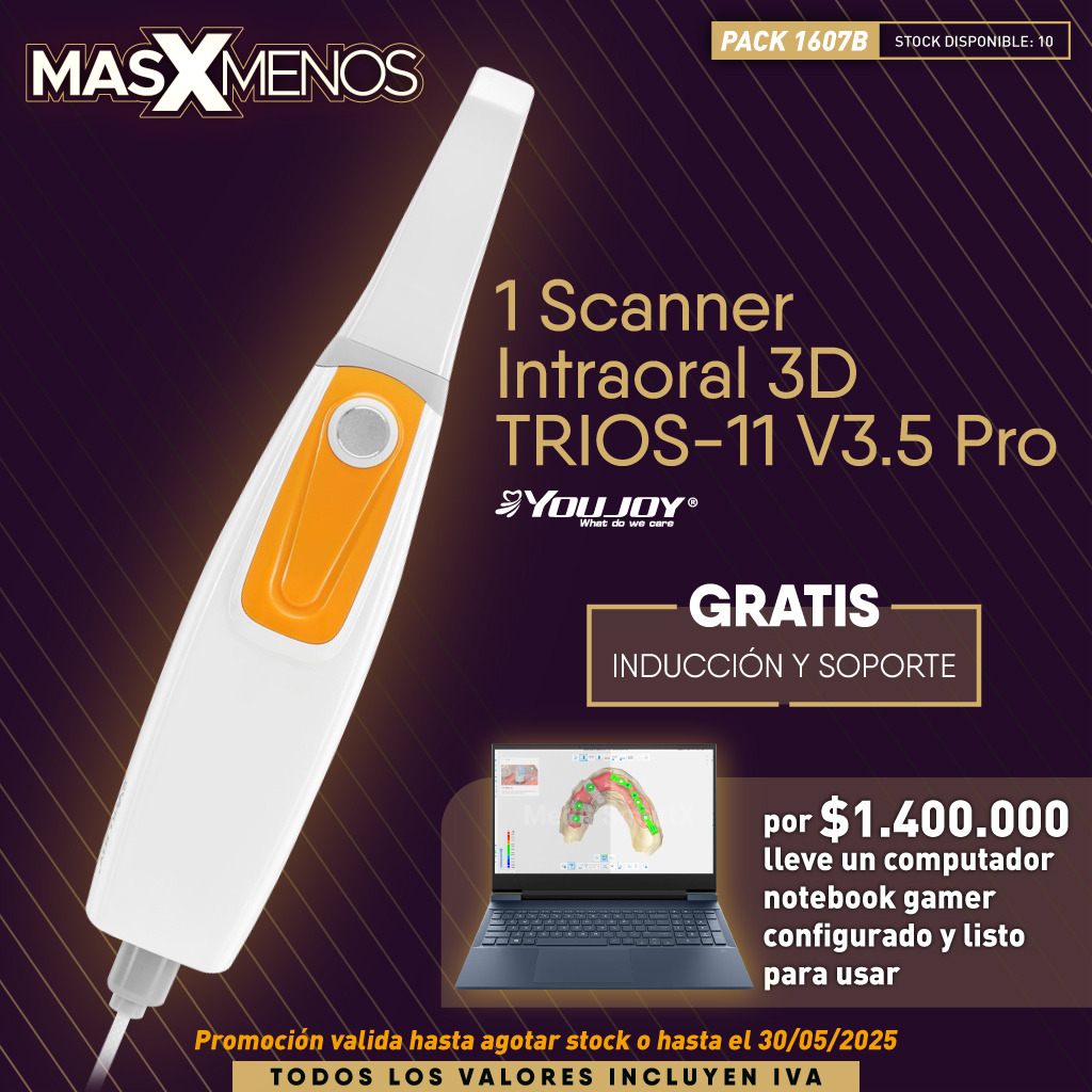 1 Scanner Intraoral 3D TRIOS-11 V3.5 Pro Youjoy + Computador Notebook Gamer