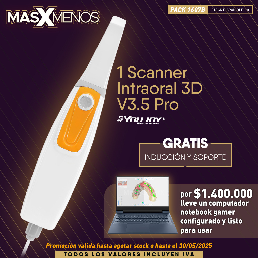 1 Scanner Intraoral 3D V3.5 Pro Youjoy + Computador Notebook Gamer