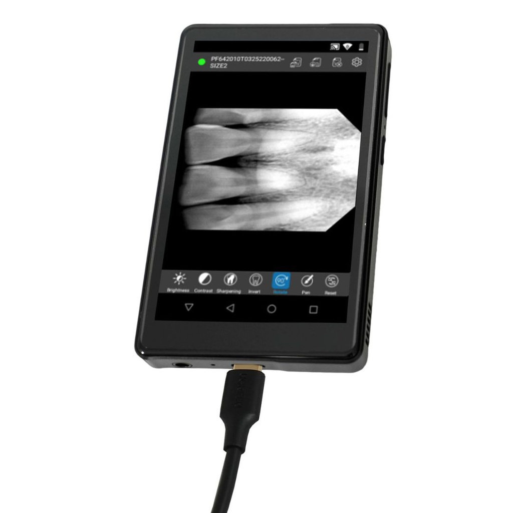 Visualizador de imagenes digital para sensor intraoral Youjoy