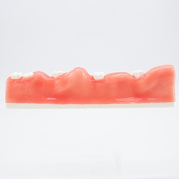 [DIA4204] Modelo estudio Extracción de dientes impactados Machtig