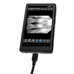 [RAD4641] Visualizador de imagenes digital para sensor intraoral Youjoy