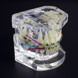 [DIA3167] Modelo estudio maxilares Ortodoncia con tratamiento B M3005-2 Machtig