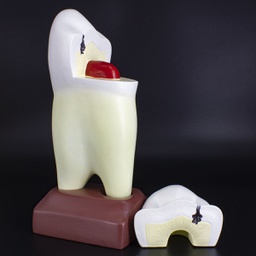 [DIA3424] Modelo estudio Premolar Magnético Machtig