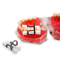 [DES3126] Porta Tórulas de Nylon x 10 Cotton roll clip Cotisen